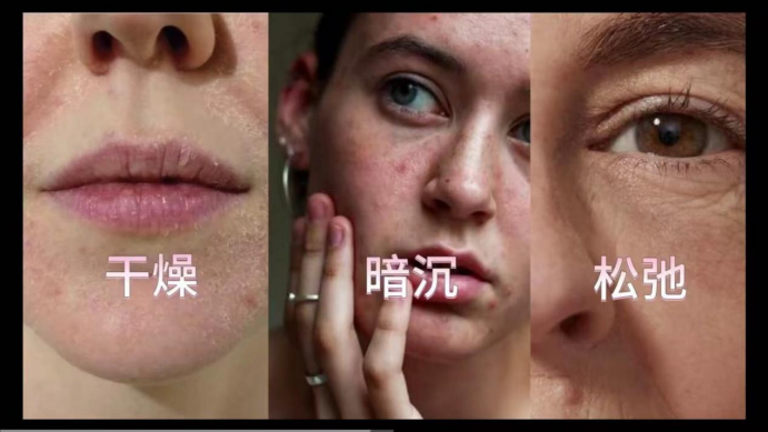 艾詩特蝦青素