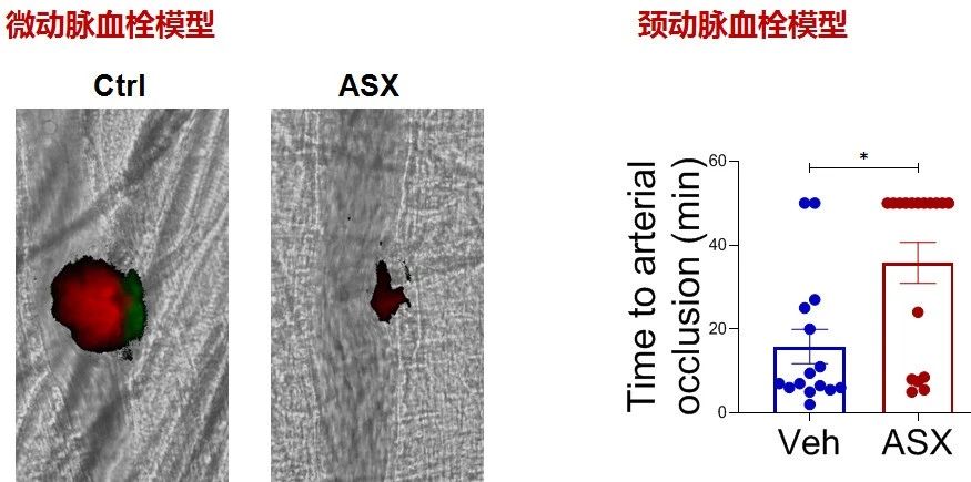艾詩特蝦青素